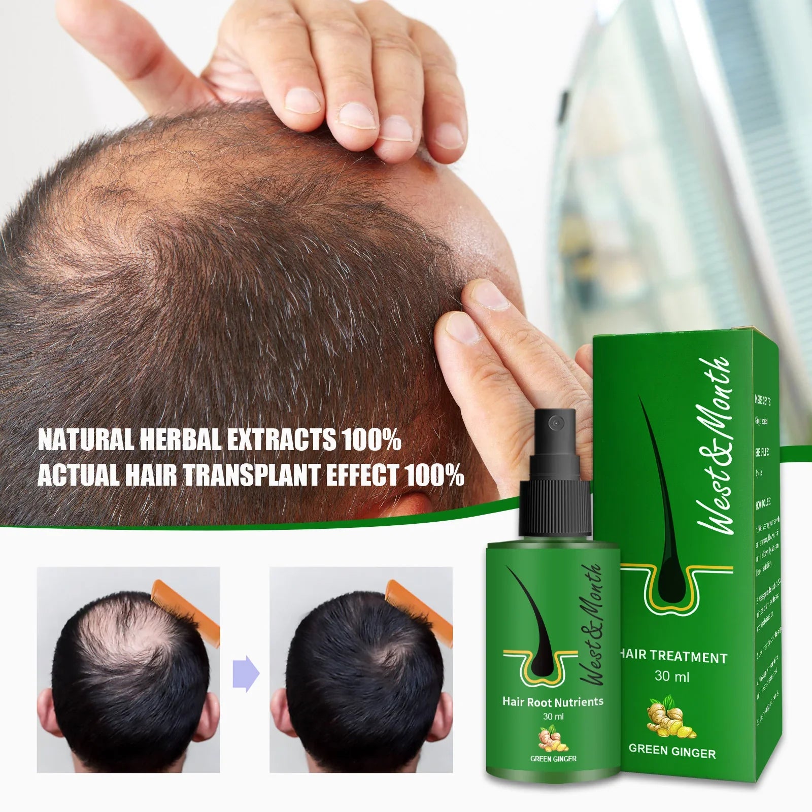 Plant Anti-Hair Loss Growth Liquid Ginger Hair-Fixing Nutrition